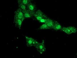 PHF7 Antibody in Immunocytochemistry (ICC/IF)