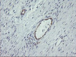 ALX4 Antibody in Immunohistochemistry (Paraffin) (IHC (P))