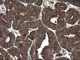 REEP5 Antibody in Immunohistochemistry (Paraffin) (IHC (P))