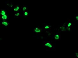 PHF7 Antibody in Immunocytochemistry (ICC/IF)