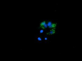 PROSC Antibody in Immunocytochemistry (ICC/IF)