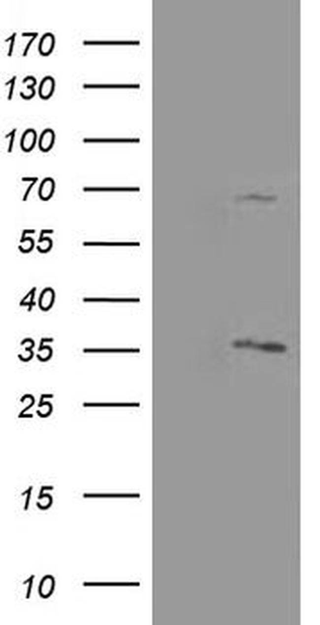 PROSC Antibody in Western Blot (WB)