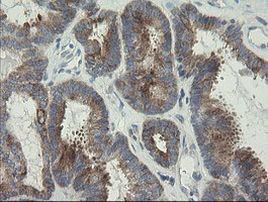 RIOK2 Antibody in Immunohistochemistry (Paraffin) (IHC (P))