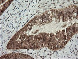 CGI-62 Antibody in Immunohistochemistry (Paraffin) (IHC (P))