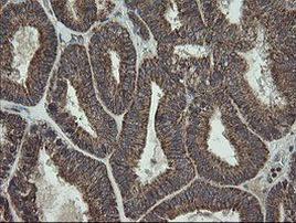 CGI-62 Antibody in Immunohistochemistry (Paraffin) (IHC (P))