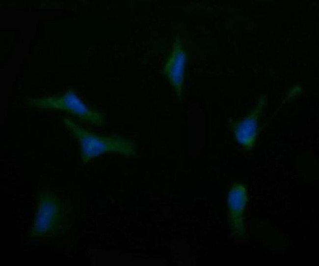 ASGR2 Antibody in Immunocytochemistry (ICC/IF)