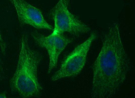 RAB37 Antibody in Immunocytochemistry (ICC/IF)