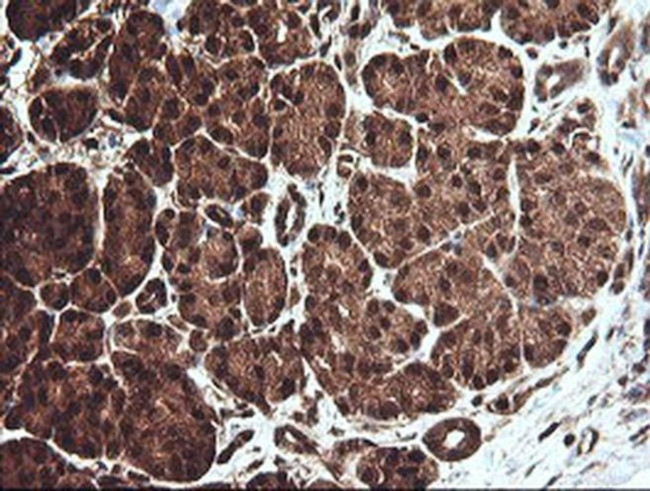 CESK1 Antibody in Immunohistochemistry (Paraffin) (IHC (P))