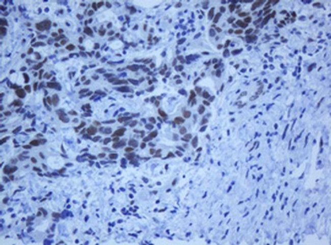 ZNF447 Antibody in Immunohistochemistry (Paraffin) (IHC (P))