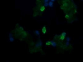 TAPBPL Antibody in Immunocytochemistry (ICC/IF)