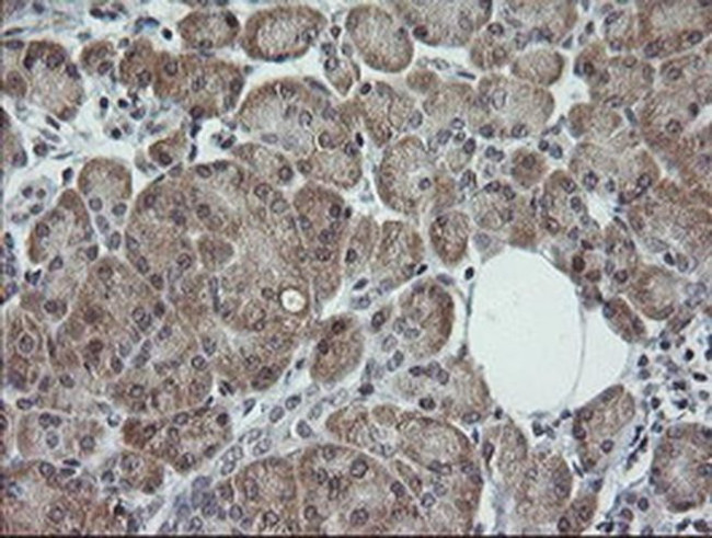 TRIM44 Antibody in Immunohistochemistry (Paraffin) (IHC (P))