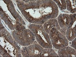 TRAPPC4 Antibody in Immunohistochemistry (Paraffin) (IHC (P))