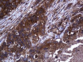COG6 Antibody in Immunohistochemistry (Paraffin) (IHC (P))