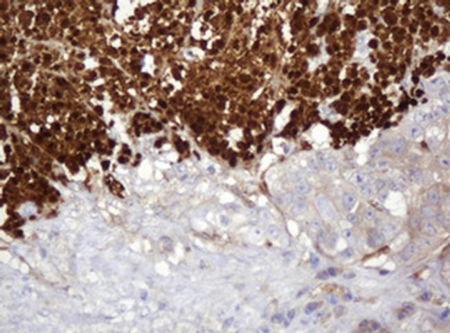 PARVB Antibody in Immunohistochemistry (Paraffin) (IHC (P))