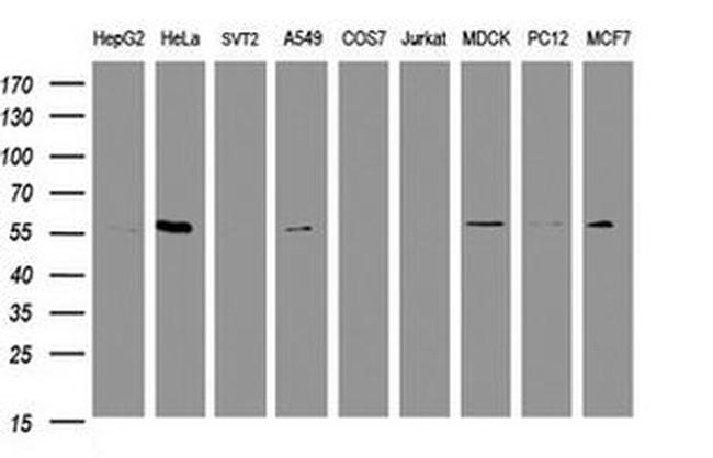 RNF23 Antibody in Western Blot (WB)