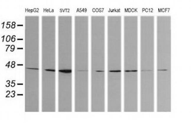 Calreticulin 3 Antibody in Western Blot (WB)