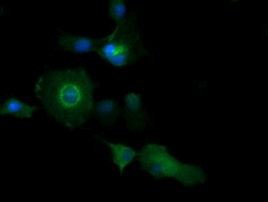 PIK3C2B Antibody in Immunocytochemistry (ICC/IF)