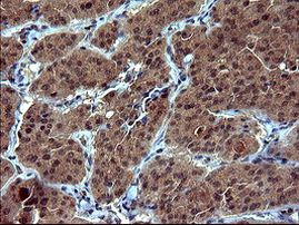 Tubulin alpha-1B Antibody in Immunohistochemistry (Paraffin) (IHC (P))