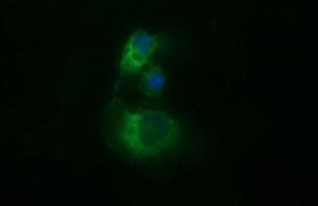 TUBB2B Antibody in Immunocytochemistry (ICC/IF)