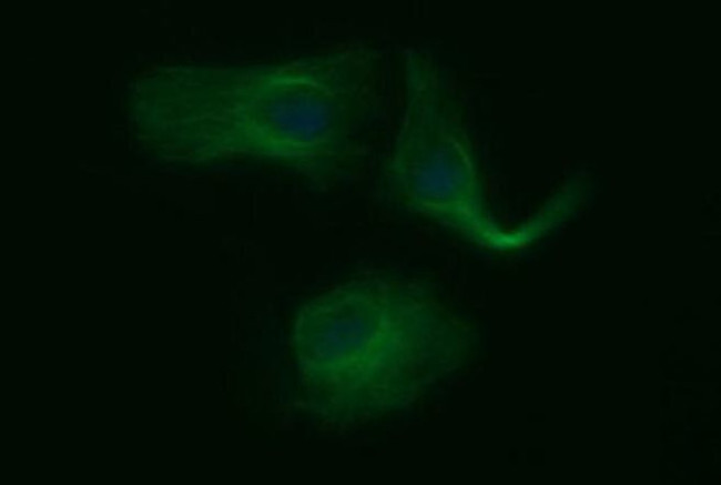 TUBB2B Antibody in Immunocytochemistry (ICC/IF)