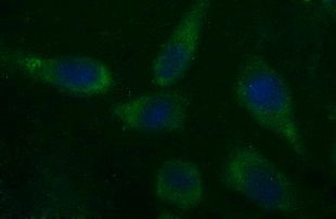 CSH1 Antibody in Immunocytochemistry (ICC/IF)