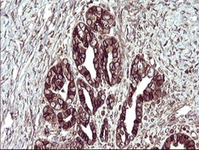 TMX Antibody in Immunohistochemistry (Paraffin) (IHC (P))