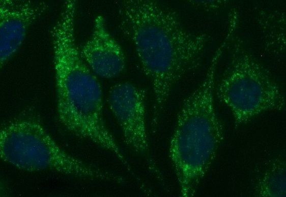 HSD17B4 Antibody in Immunocytochemistry (ICC/IF)
