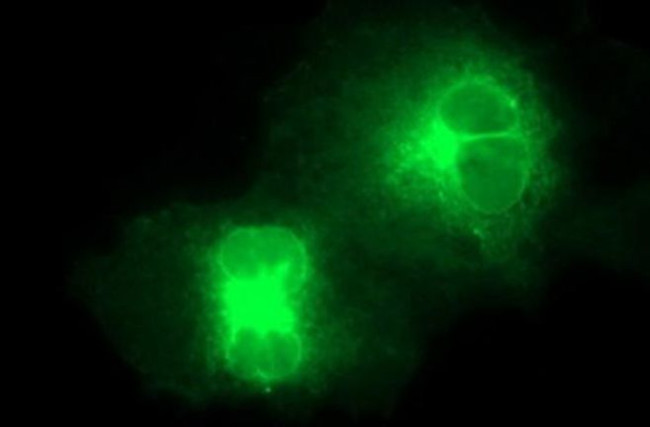 SR-BI Antibody in Immunocytochemistry (ICC/IF)