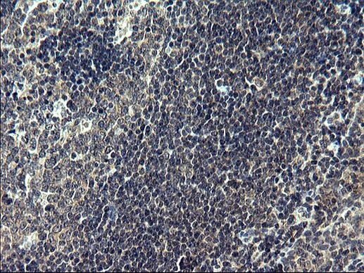 FNDC8 Antibody in Immunohistochemistry (Paraffin) (IHC (P))