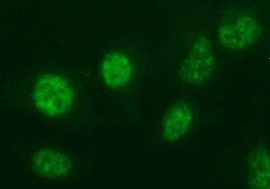 ANR49 Antibody in Immunocytochemistry (ICC/IF)