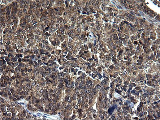 SCP2 Antibody in Immunohistochemistry (Paraffin) (IHC (P))