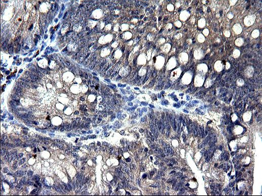 TXNDC5 Antibody in Immunohistochemistry (Paraffin) (IHC (P))