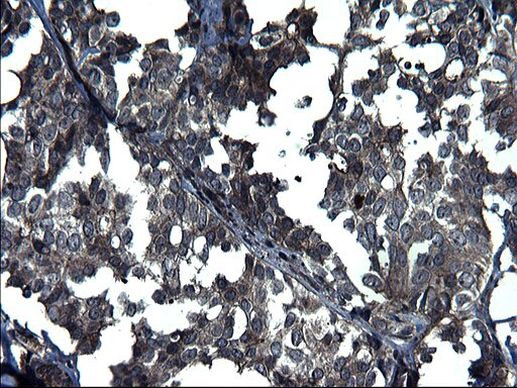 ANKMY2 Antibody in Immunohistochemistry (Paraffin) (IHC (P))