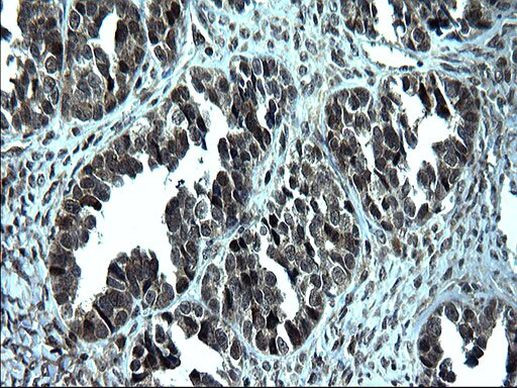ZFAND3 Antibody in Immunohistochemistry (Paraffin) (IHC (P))