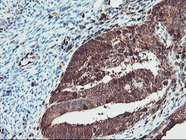 SERPINB1 Antibody in Immunohistochemistry (Paraffin) (IHC (P))