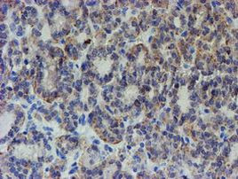 ZNF365 Antibody in Immunohistochemistry (Paraffin) (IHC (P))