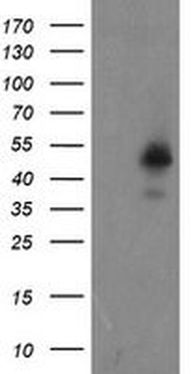 ZNF365 Antibody in Western Blot (WB)