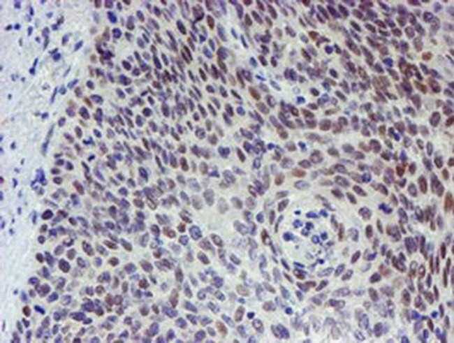 TPRKB Antibody in Immunohistochemistry (Paraffin) (IHC (P))