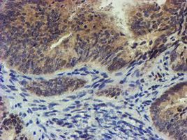 TIGD1 Antibody in Immunohistochemistry (Paraffin) (IHC (P))