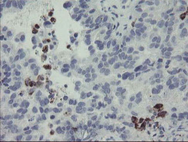 MYL7 Antibody in Immunohistochemistry (Paraffin) (IHC (P))