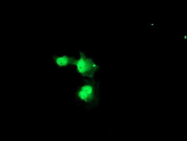 NYREN18 Antibody in Immunocytochemistry (ICC/IF)