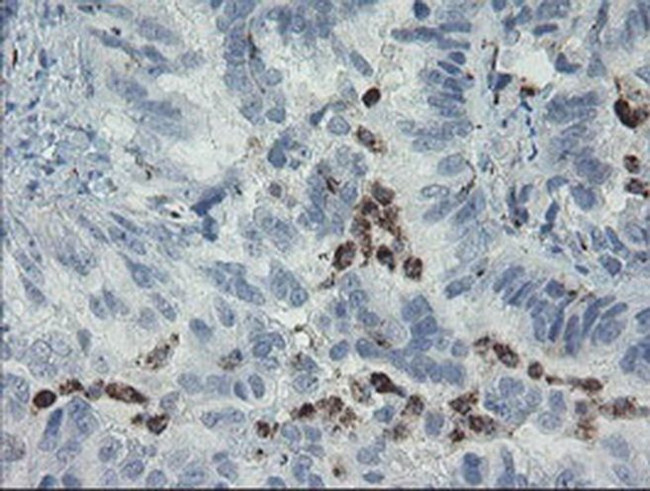 MYL7 Antibody in Immunohistochemistry (Paraffin) (IHC (P))