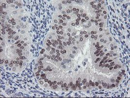 MEIS3 Antibody in Immunohistochemistry (Paraffin) (IHC (P))