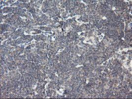 RIP1 Antibody in Immunohistochemistry (Paraffin) (IHC (P))