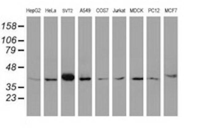 A4GNT Antibody in Western Blot (WB)