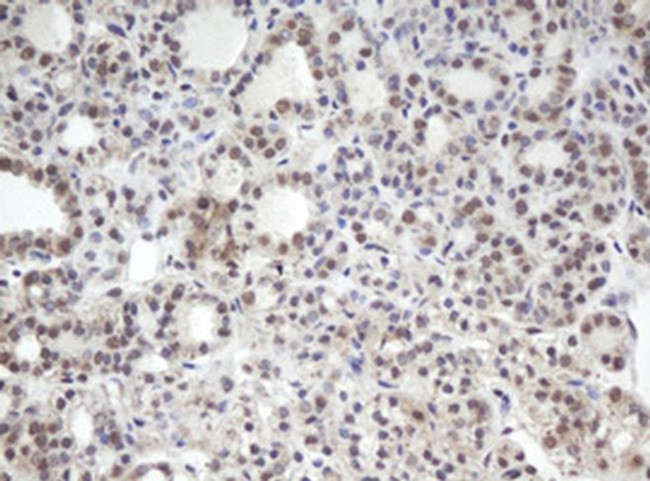 MORF4 Antibody in Immunohistochemistry (Paraffin) (IHC (P))