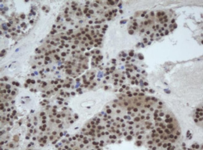 Cullin 4B Antibody in Immunohistochemistry (Paraffin) (IHC (P))