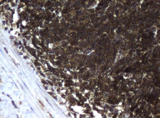 CCDC93 Antibody in Immunohistochemistry (Paraffin) (IHC (P))