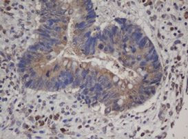 HBS1L Antibody in Immunohistochemistry (Paraffin) (IHC (P))