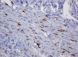 SOAT2 Antibody in Immunohistochemistry (Paraffin) (IHC (P))
